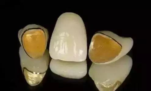 为什么烤瓷牙表面有裂纹,为什么烤瓷牙的牙龈那么黑