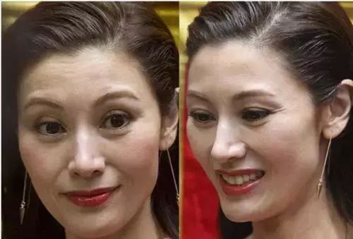 抗皱纹抗老小妙招,30岁后的面部抗老思路