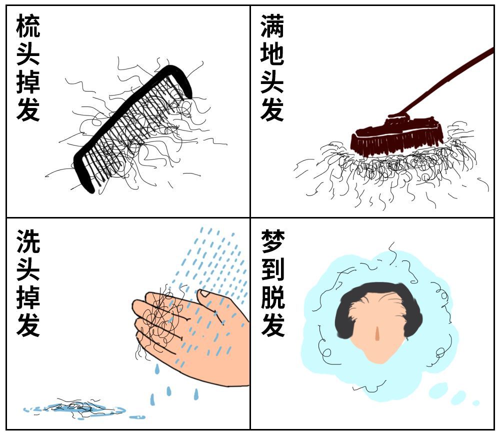 脂溢性脱发案例,脂溢性脱发生发视频