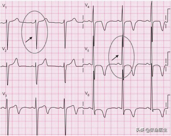 感觉心脏不好基本检查有哪些,总感觉心脏有病还检查不出来