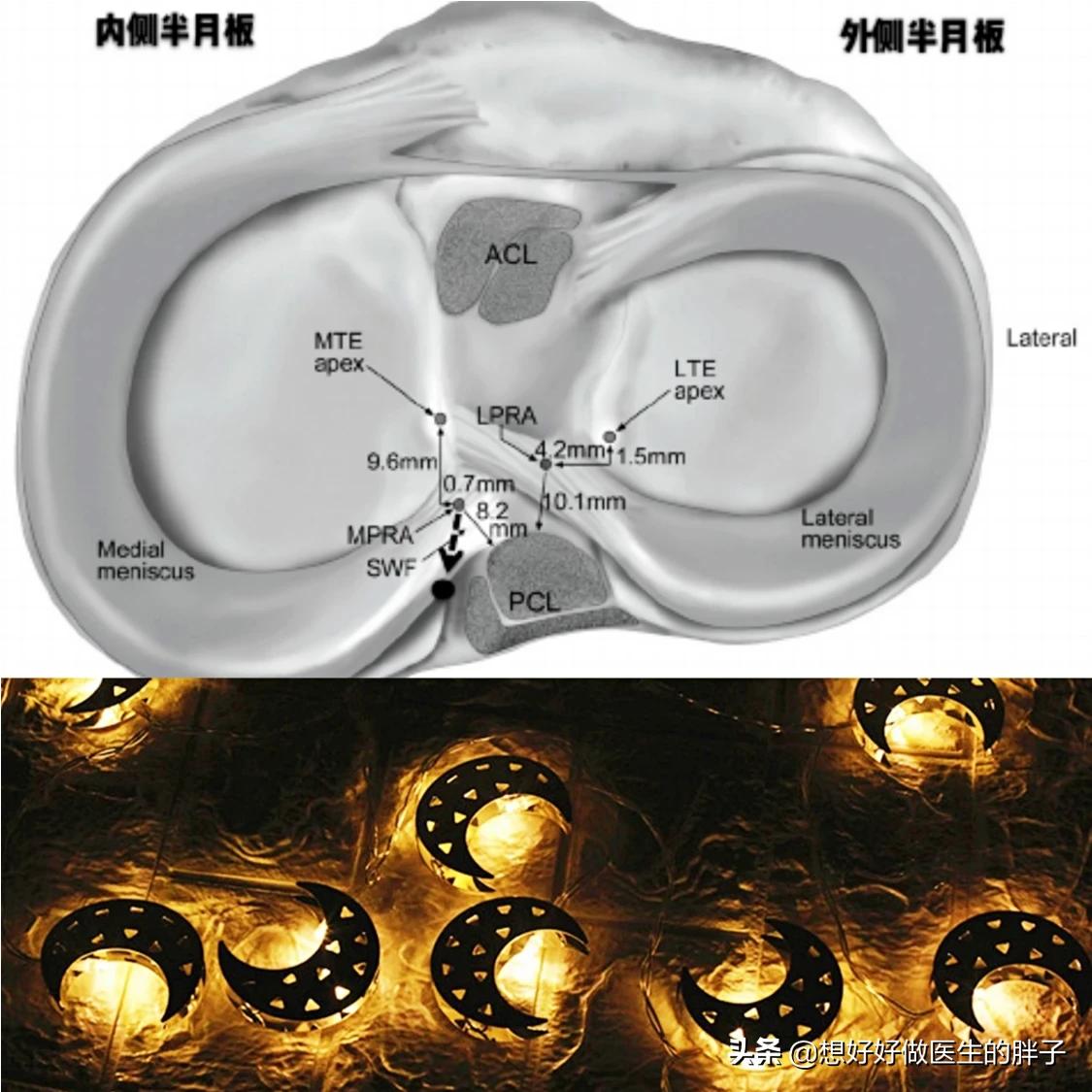 足球运动员为什么没有半月板,足球到底伤半月板吗