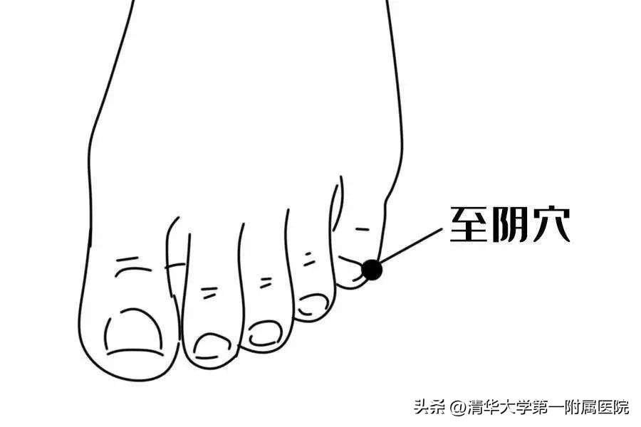 准妈妈胎位不正，中医有办法