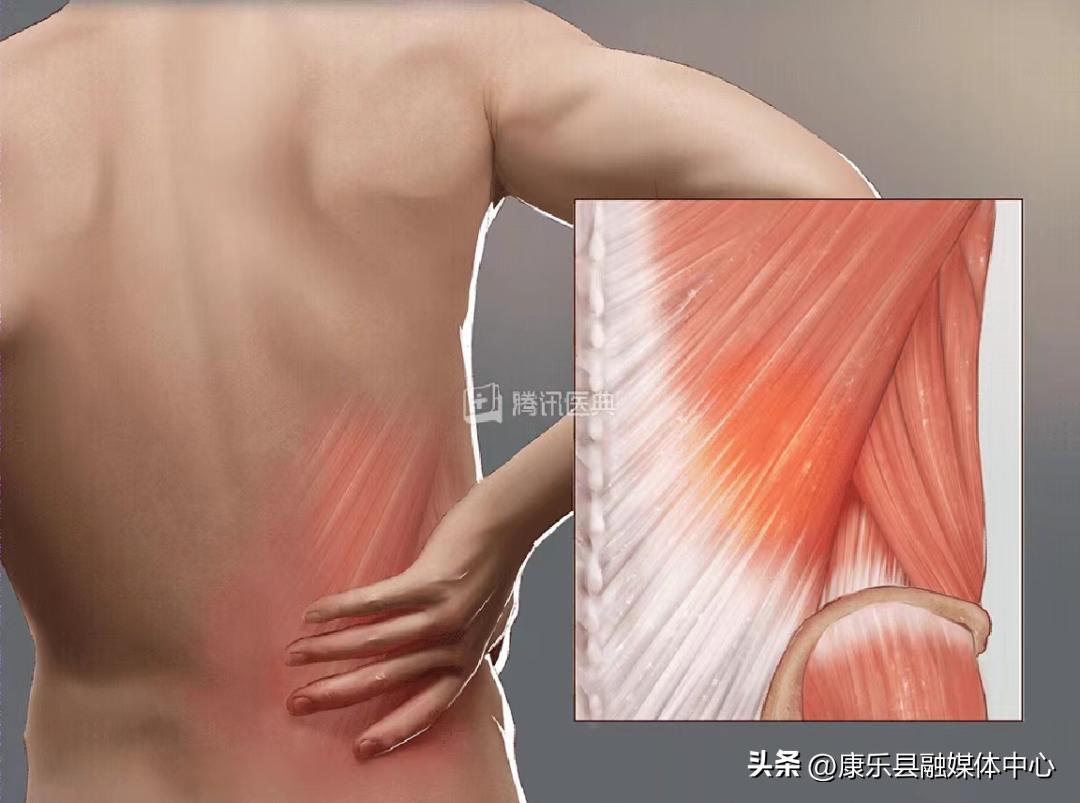 过度劳累会引起下身疼痛,劳累后腰痛是什么原因