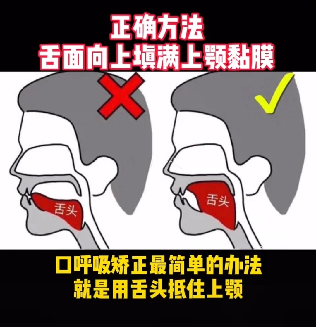 下巴短和后缩怎么变美,下巴后缩怎么矫正嘴尖