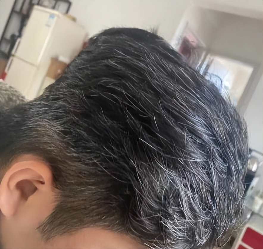 头发白吃什么变黑发最有效,长白头发要吃什么滋补品