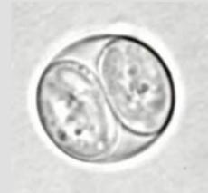 怀孕接触弓形虫的猫多久能感染,孕期非常担心感染弓形虫怎么办