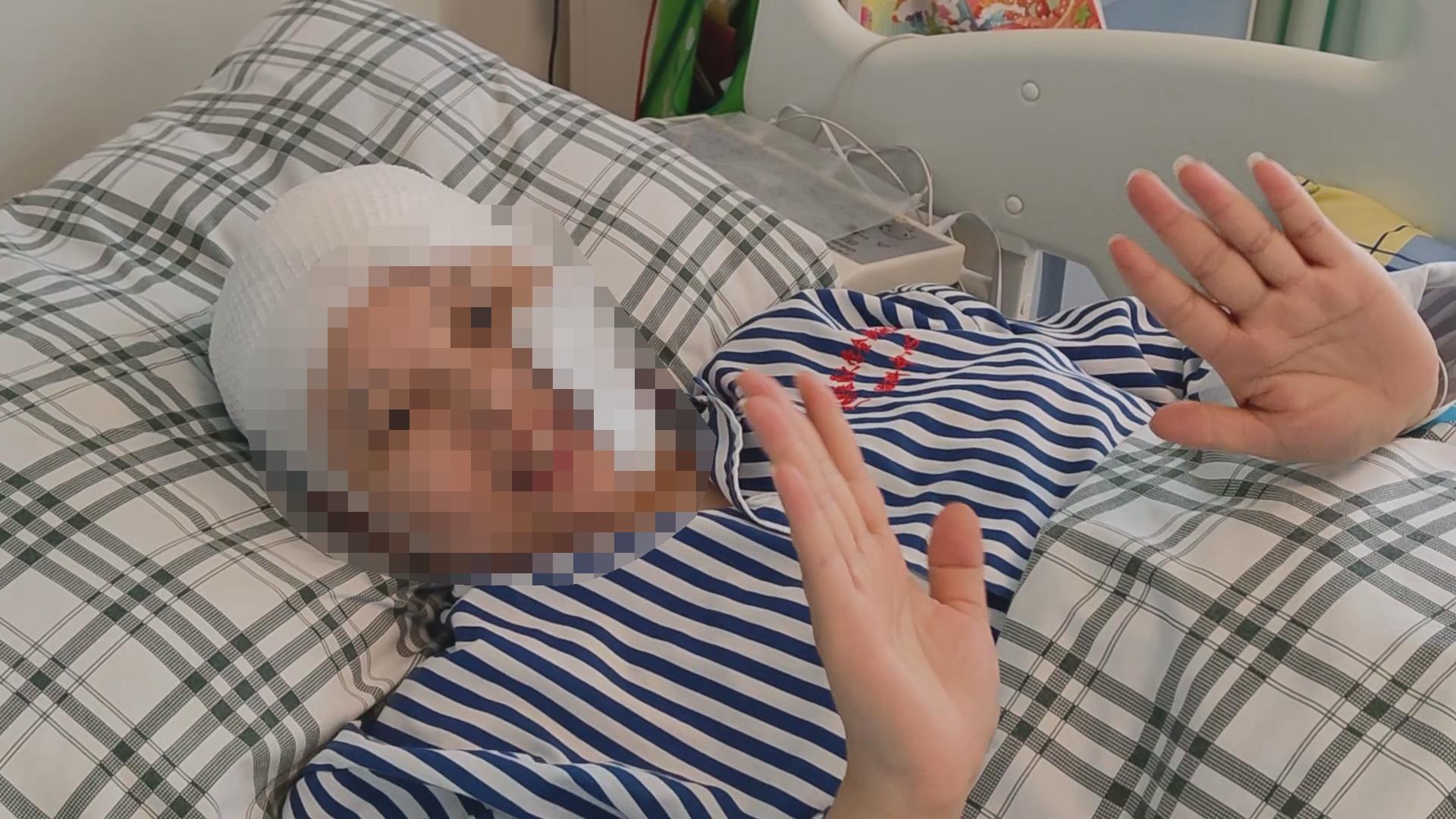 脸被挤压变形,脸被挤压变形了