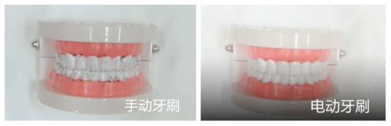 品牌的电动牙刷就不伤牙吗,usmile和欧乐b电动牙刷哪个好