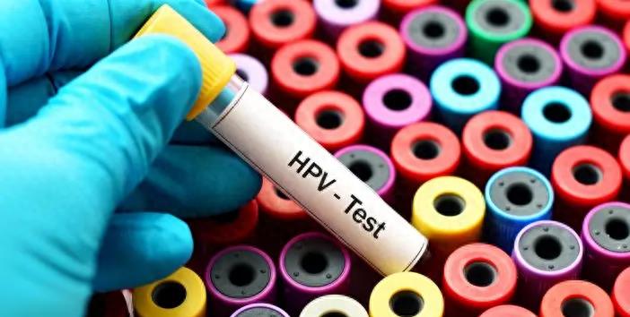 全球最美女人之一去世，仅26岁！曾在中国参加选美比赛，外网悼念