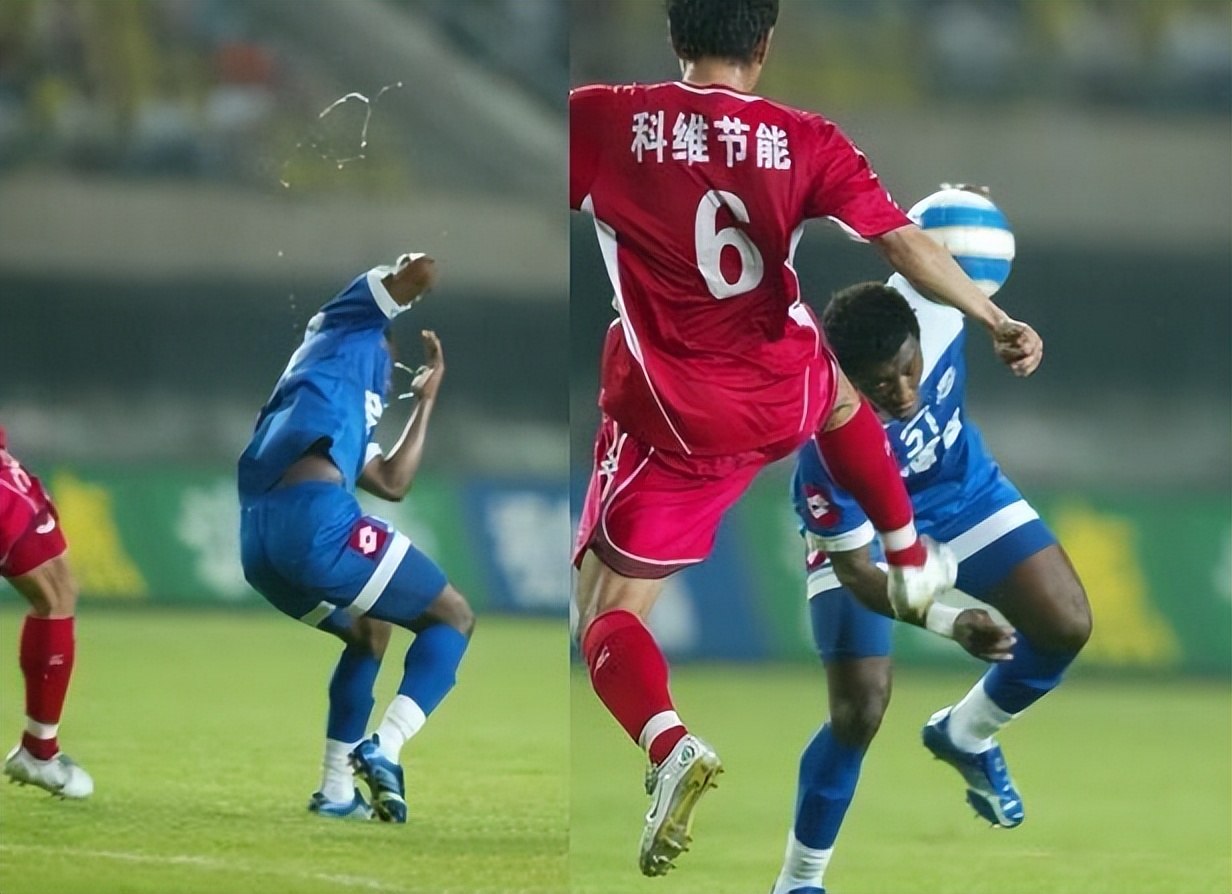 中超史上最悲伤的球员,中超被踢瞎眼睛的外援怎样了