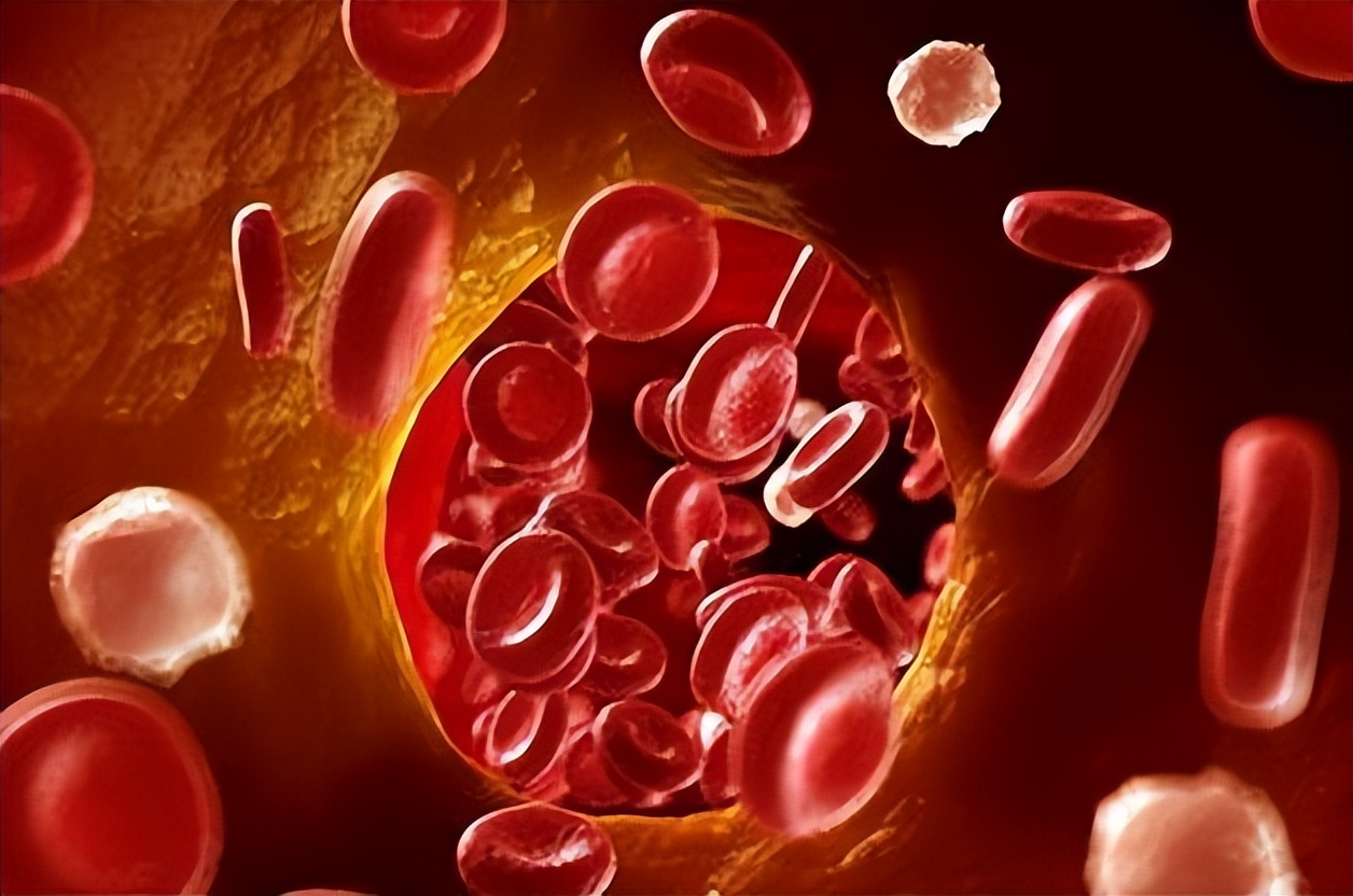 气虚血虚又血瘀吃什么中成药,血燥血虚湿气太重身痒