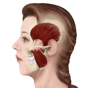 为什么整牙脸会小,为什么整牙期间脸会变老