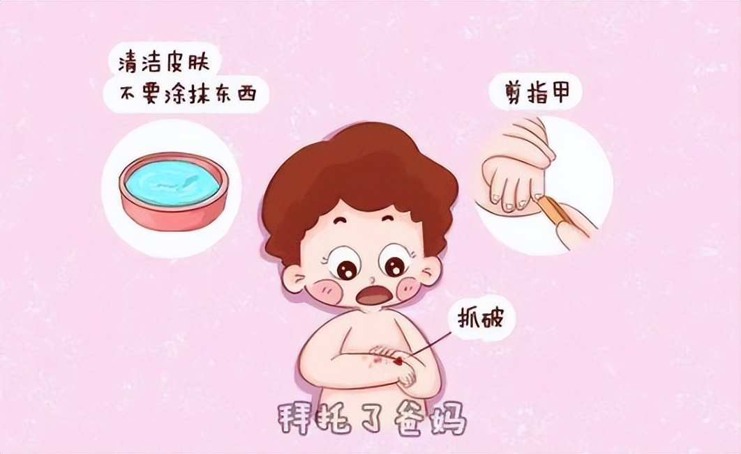 宝宝长痱子怎么快速消除止痒,夏天出痱子有什么办法祛痱止痒
