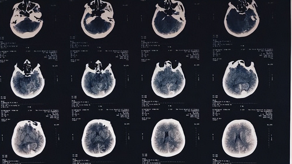 透明质酸钠修复凝胶医用,医用透明质酸钠凝胶防增生吗