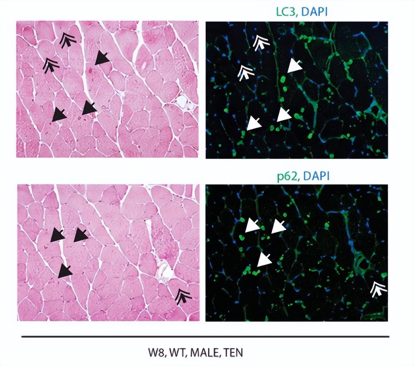 核因子,NFκB,在临床治疗上,是否与腱切断术的肌肉萎缩无关?