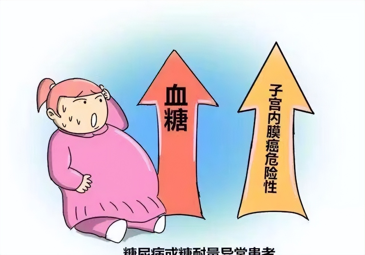 科普|“嫌贫爱富”的子宫内膜癌