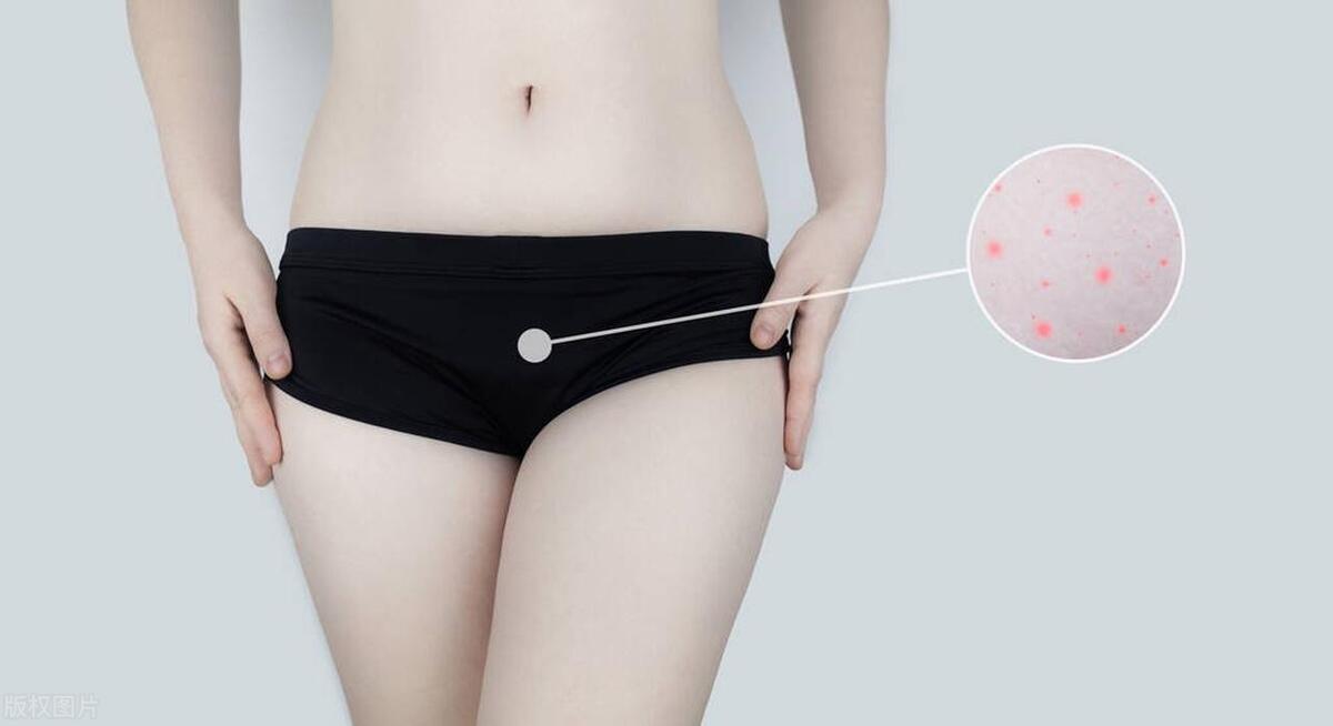 阴道炎的种类及症状治疗药物,各类阴道炎的症状及用药