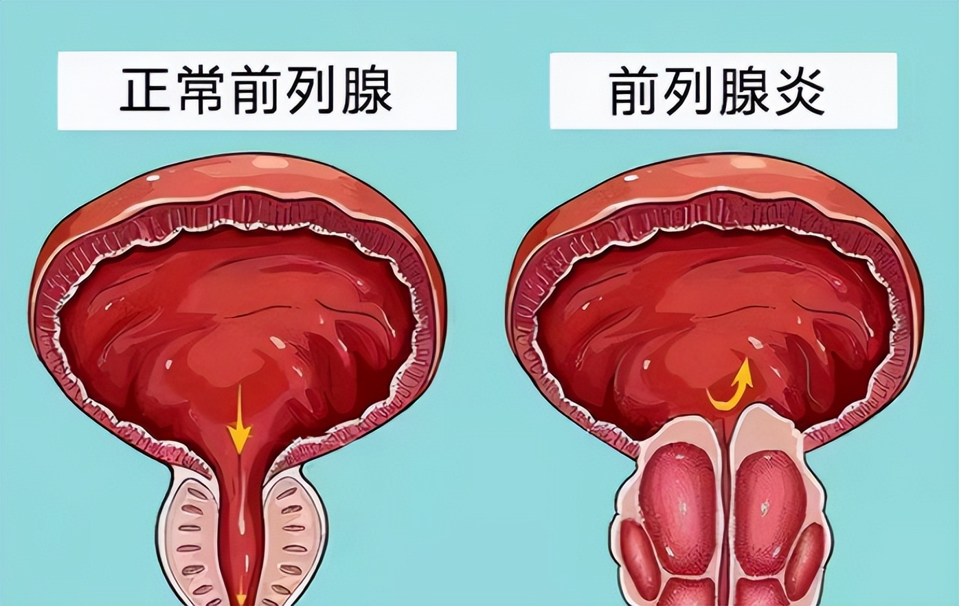 6岁前骑车会影响生殖功能？这究竟是不是谣言？听听专家怎么说