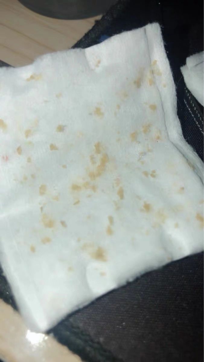 超微小气泡美容有用吗,美容院小气泡