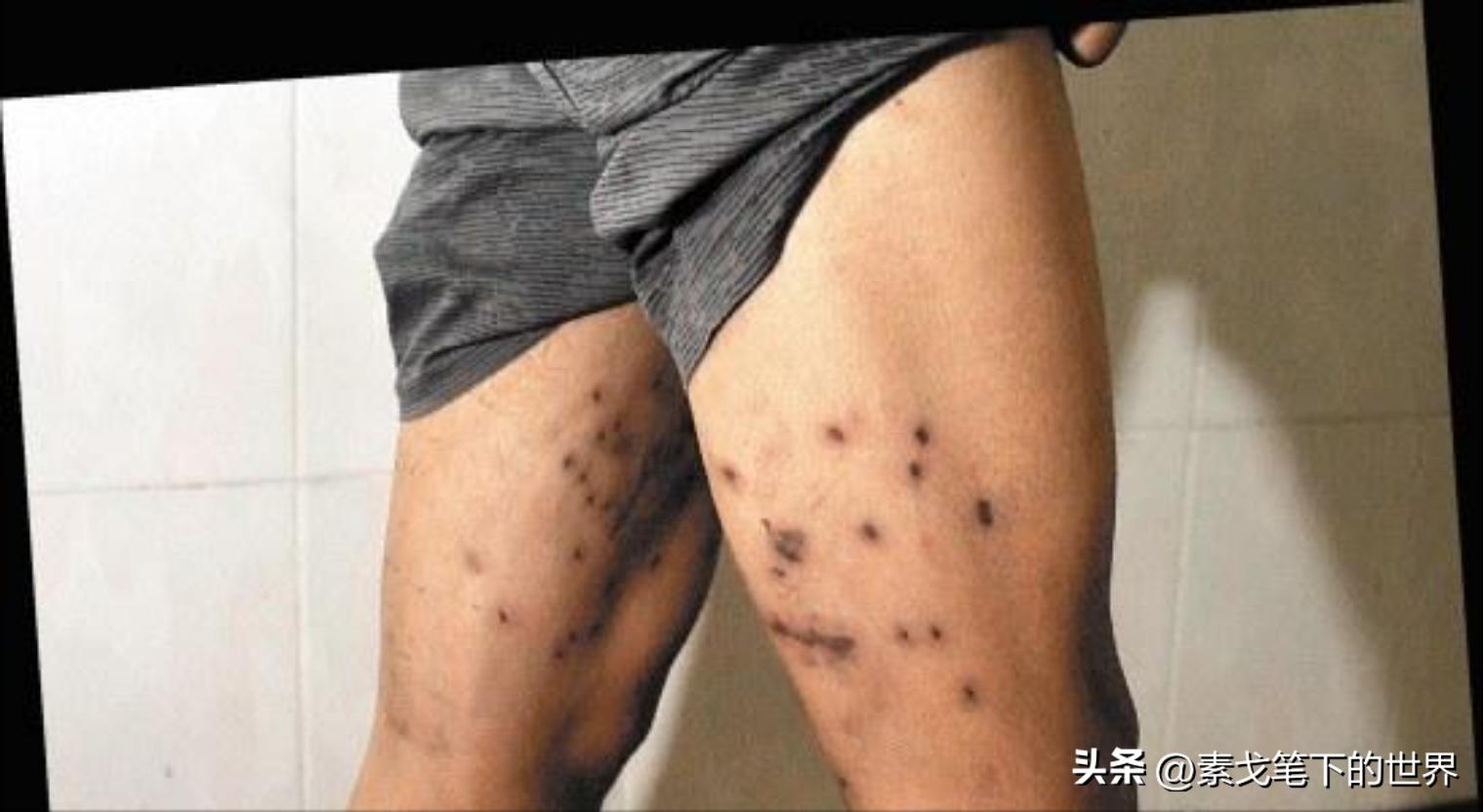 村民夜钓疑被当成野猪,江西夜钓被当野猪打