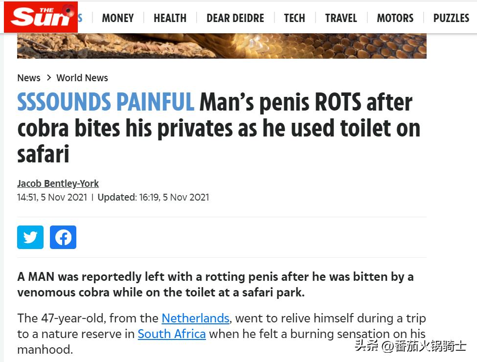 荷兰男子南非上厕所被剧毒喙眼镜蛇咬伤*体下**,结果溃烂部分被切除