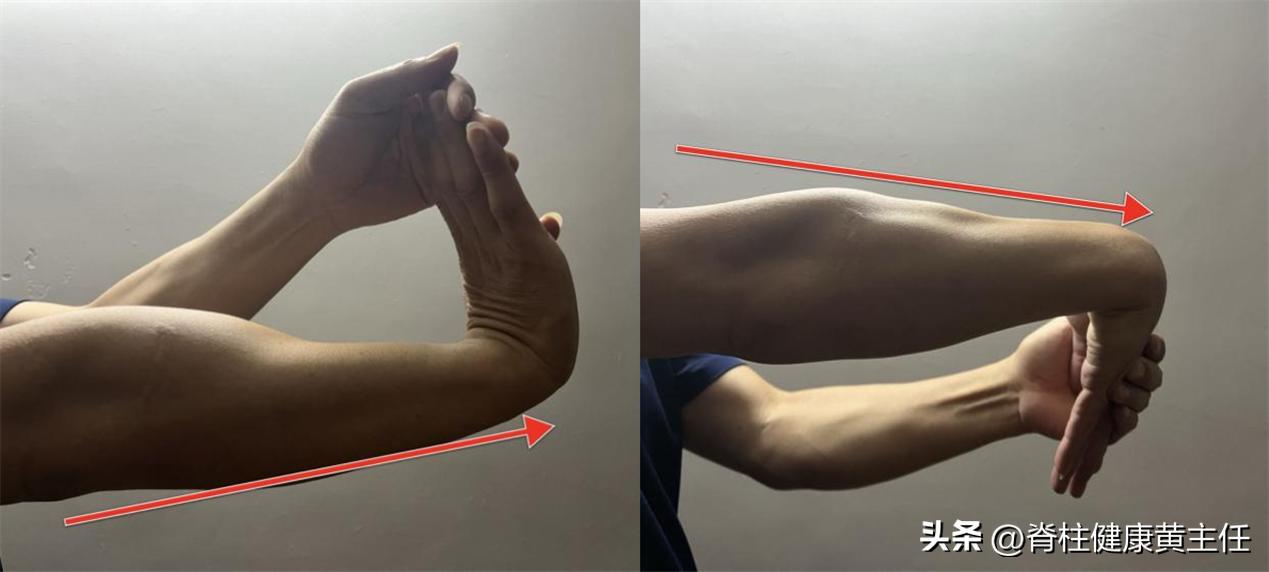 什么是高尔夫球肘该如何治疗,高尔夫球肘康复要多久