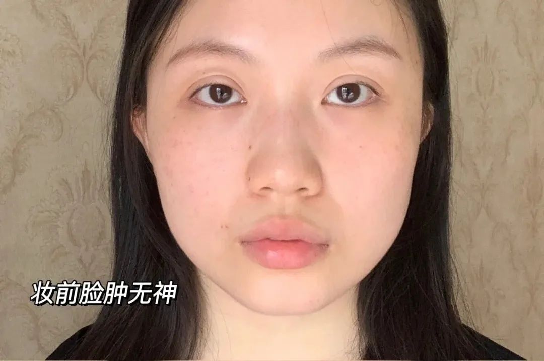 疲惫脸色不好怎么办,疲惫脸补救