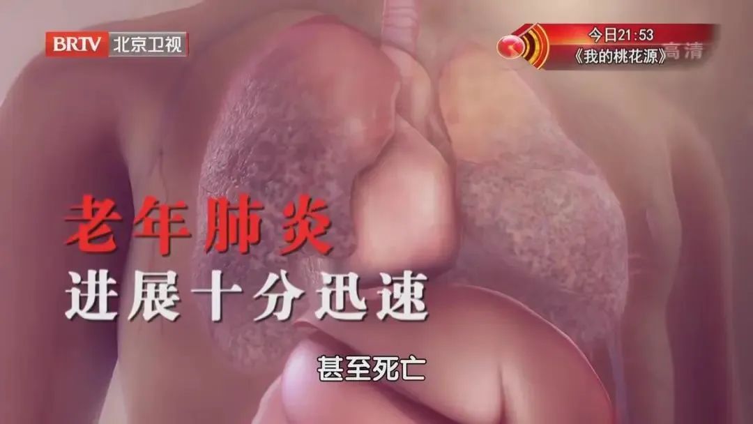 预防肺炎吃什么食物最好,老年肺炎宜吃什么食物