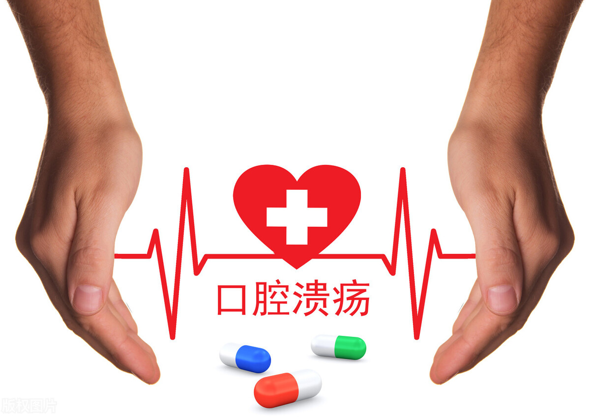 口腔溃疡癌变怎么能看出早期晚期,口腔溃疡癌变早期症状的治疗方法