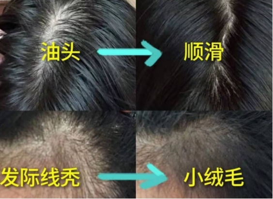 孕妇可以用的防脱洗发水推荐,推荐款好的洗发水孕妇也能用的