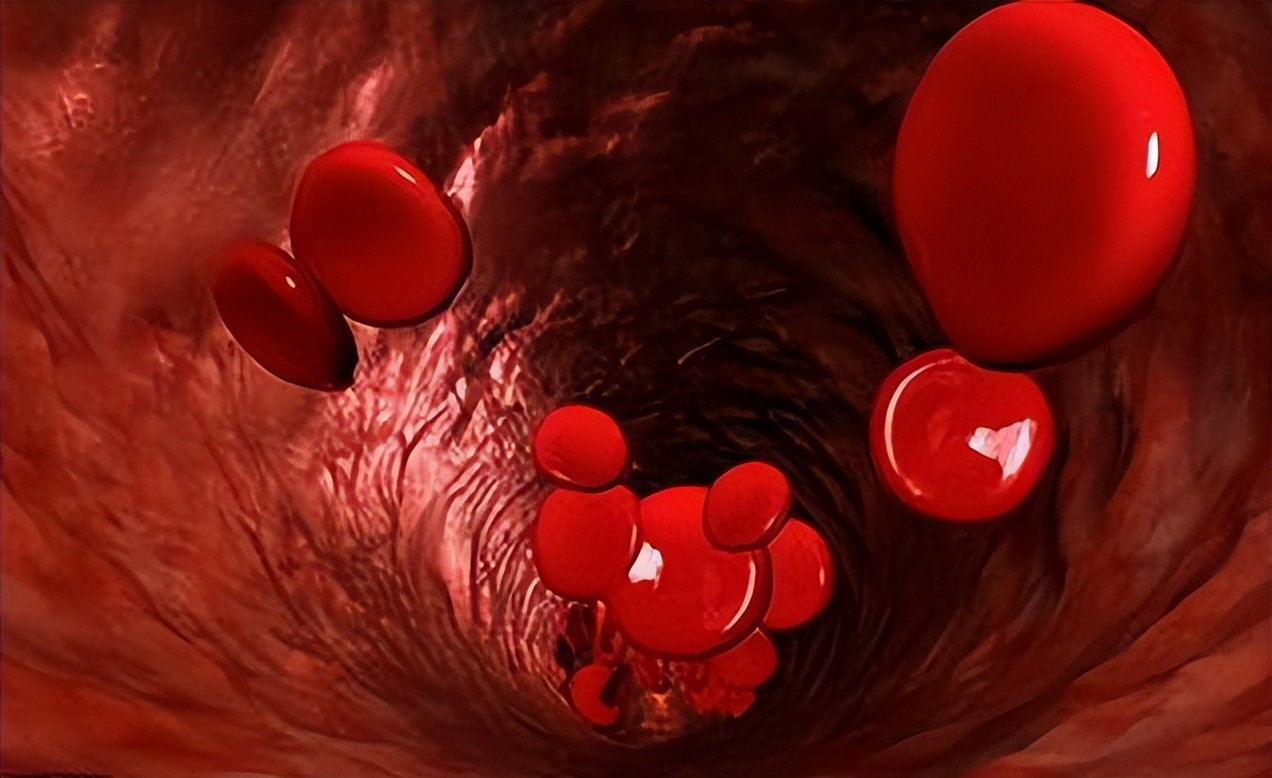 病从血中来是真的假的,中医调理心梗方法