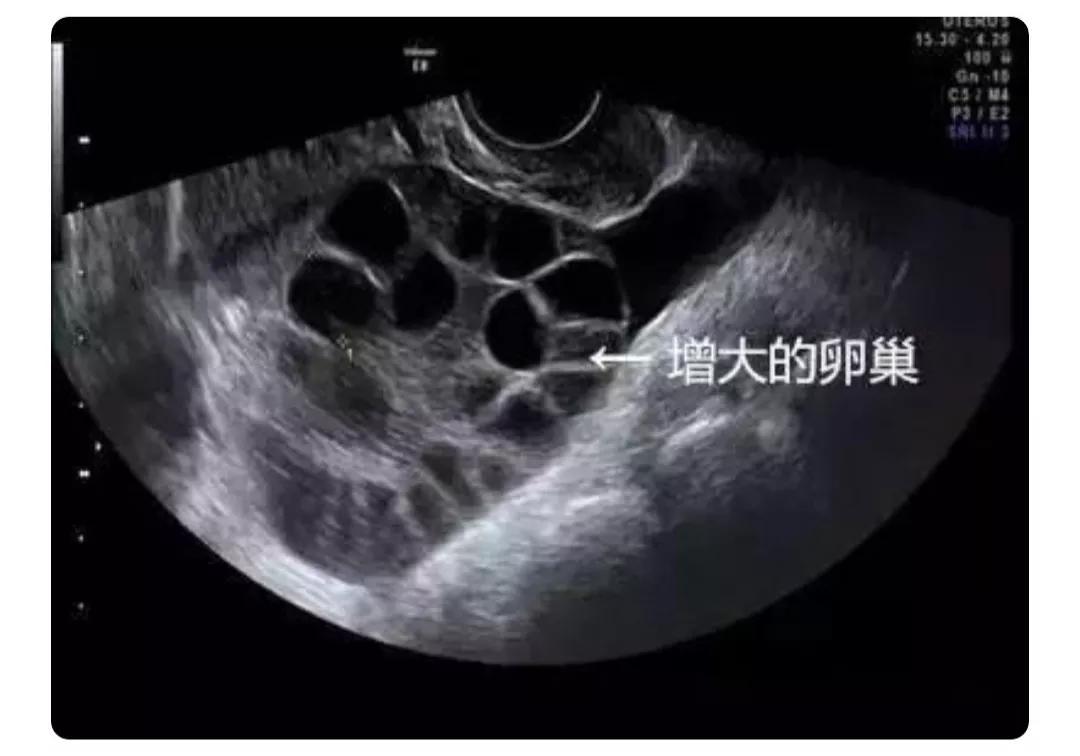 澶у濂崇敓鍘曟墍閬囧,鐢峰鐢熻蛋杩涘コ鍘曟墍浜嬩欢