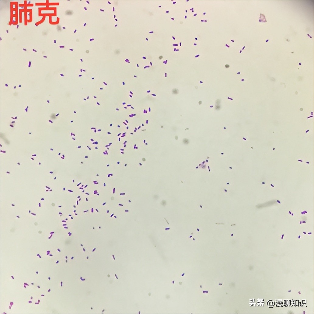 老年人得了肺炎应如何有效医治,肺炎有多严重怎么办