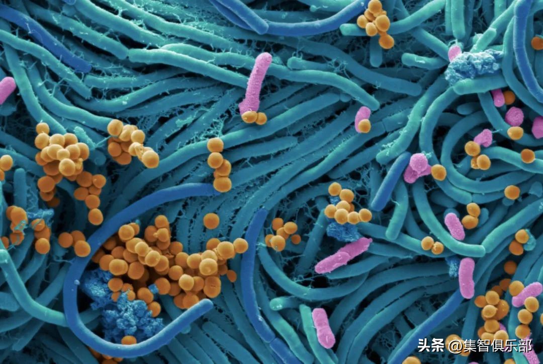 衰老分为生理性衰老和病理性衰老,衰老的特点与相关理论