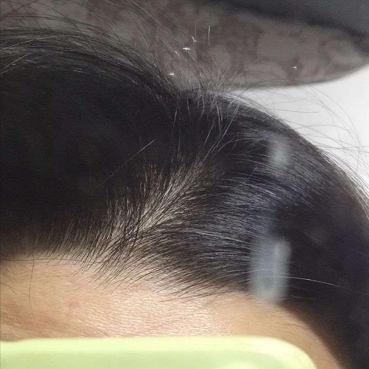 防脱洗发水好文,防脱洗发水用一次有没有事