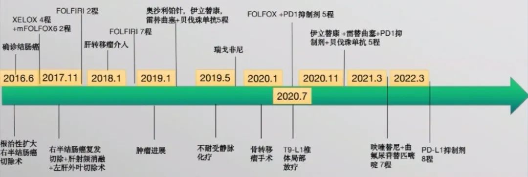 多原发癌症转移,多原发直肠癌