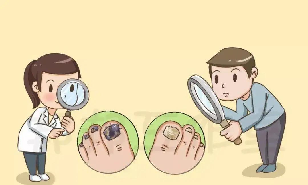 灰指甲在医院看哪个科,甲沟炎灰指甲在医院挂什么科