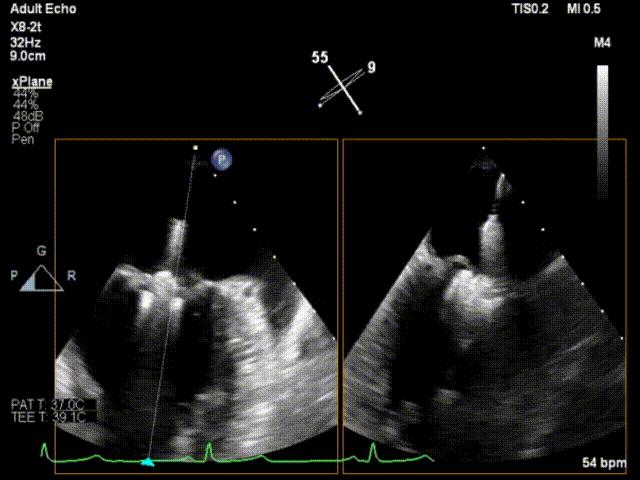 杨剑教授中国科学院,西京医院心血管外科杨剑