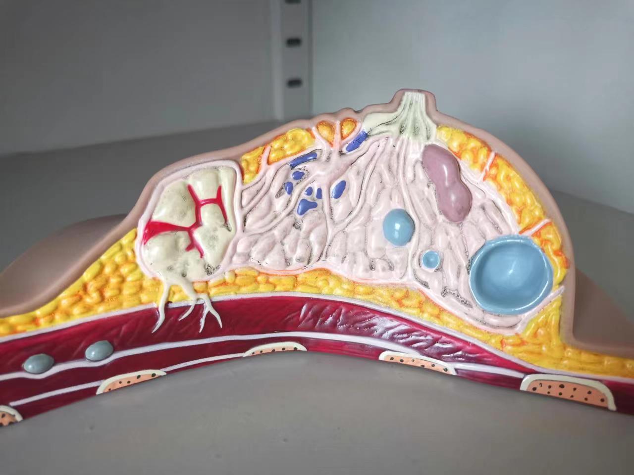 bi-rads分级4级,birads4级是癌么