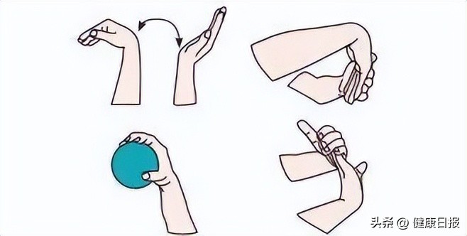 鼠标手和妈妈手都是腕管综合征吗,鼠标手和妈妈手