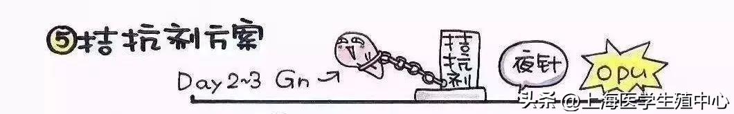 试管促排第8天日记,试管婴儿常见的促排方案