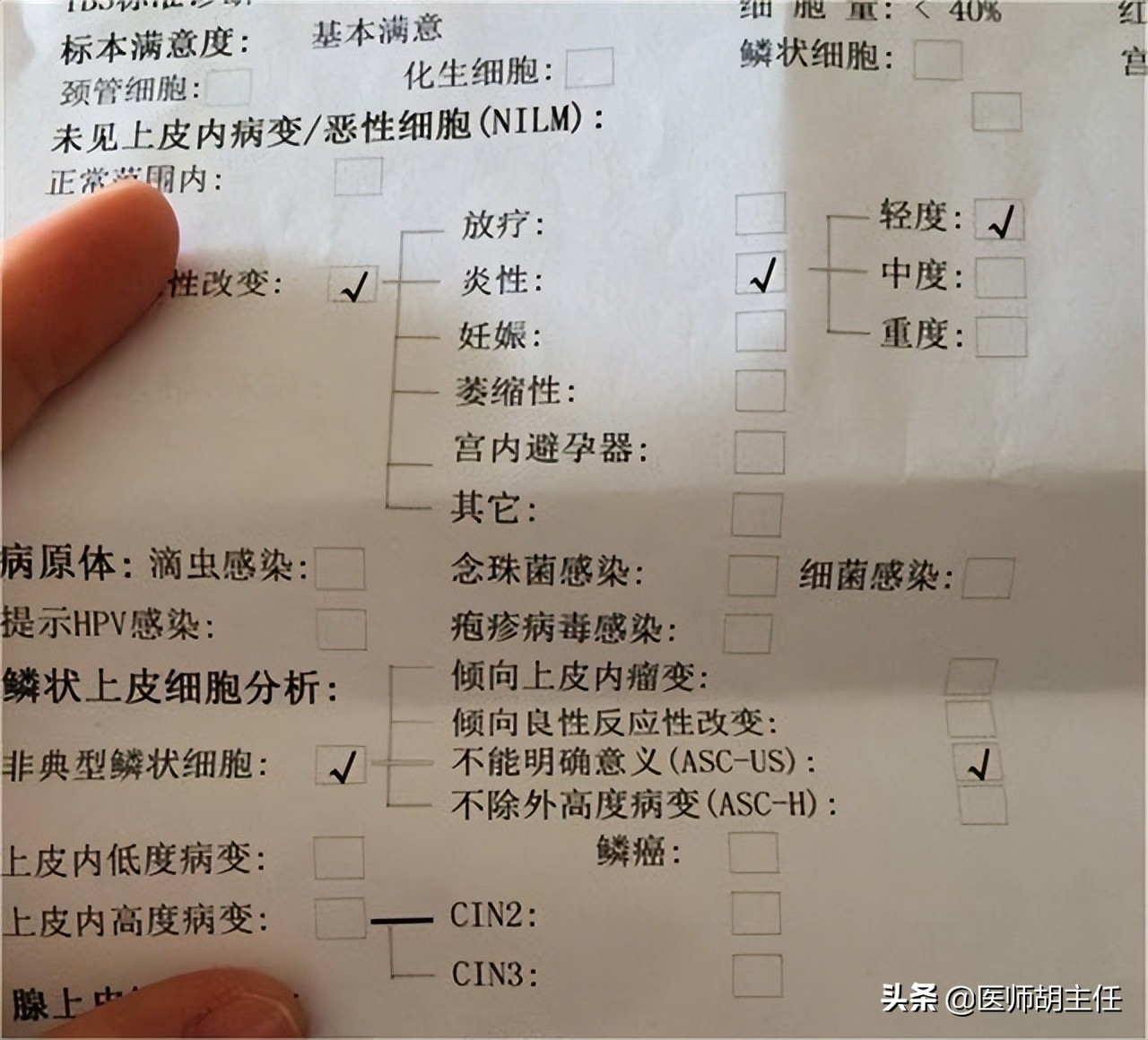 30岁腿痛查出宫颈癌案例,宫颈癌晚期腿上4个信号提示