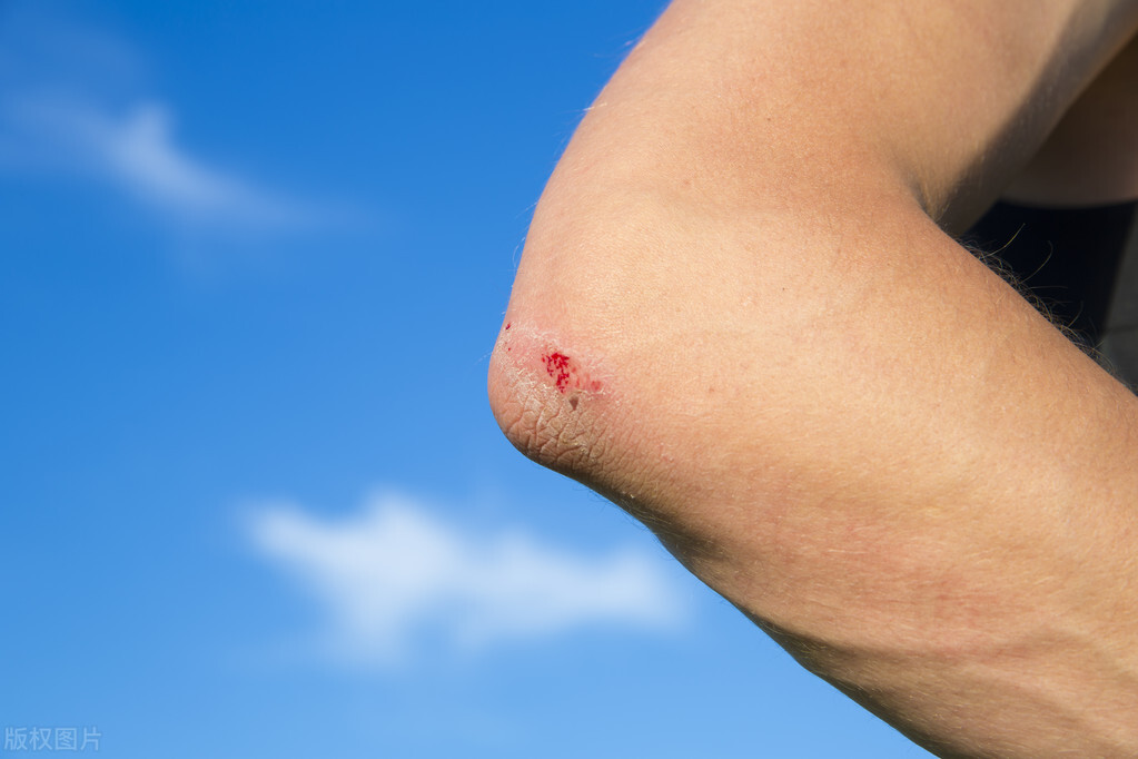 微轻伤和轻微伤的区别,脱臼算轻伤还是轻微伤