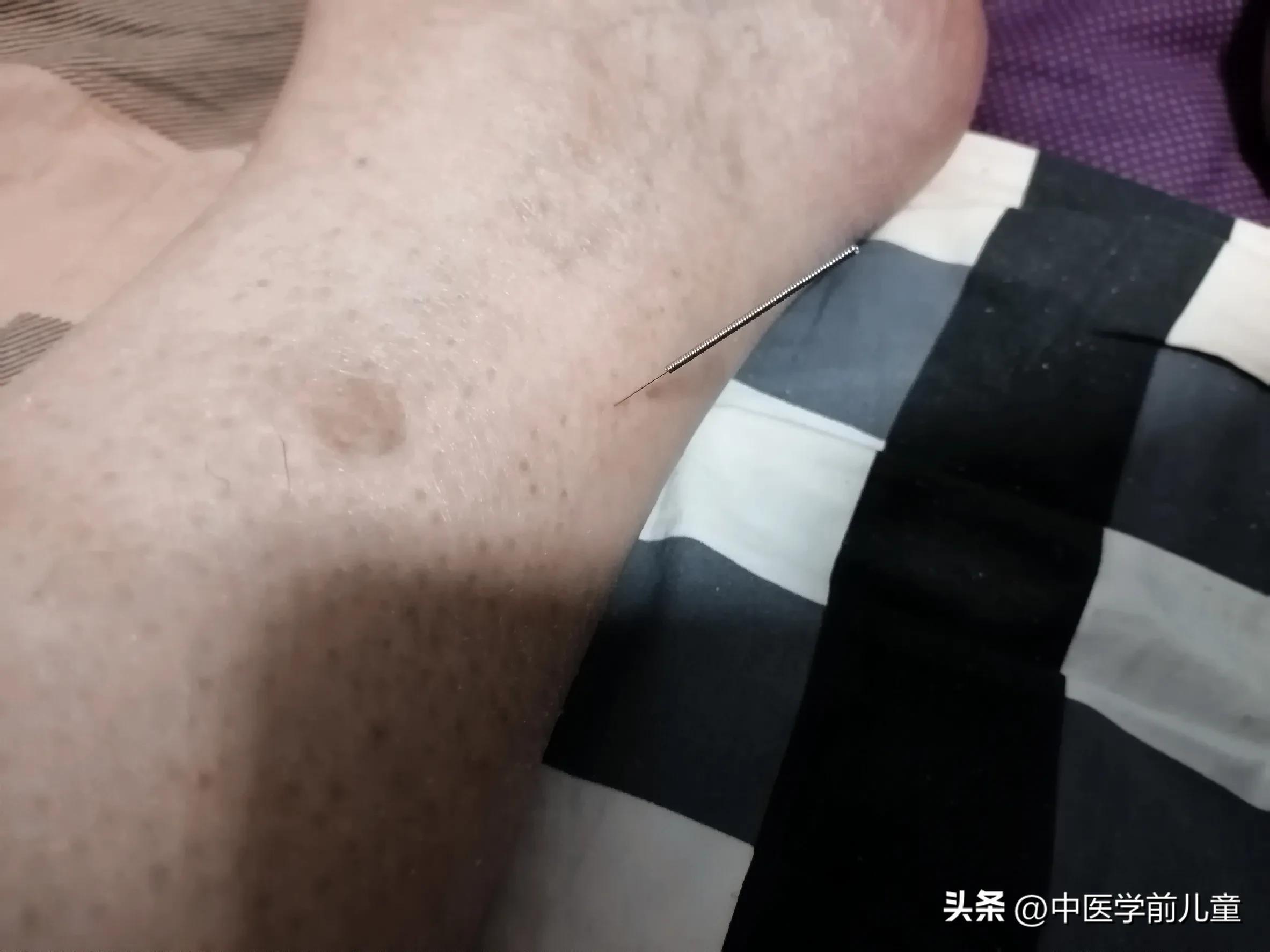 口唇干舌燥针灸穴位,口干舌燥一招解决推拿