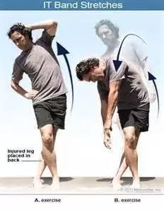 髂胫束会不会引起膝盖外侧疼痛,膝盖外侧髂胫束炎最好的治疗方法