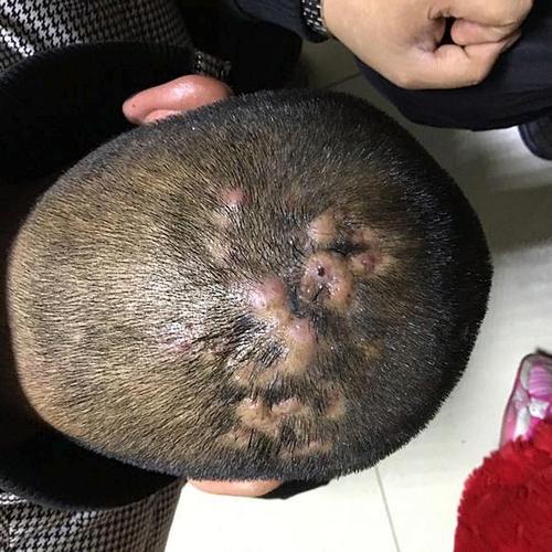 这些生发误区你还在做吗,这些防脱发产品你值得拥有