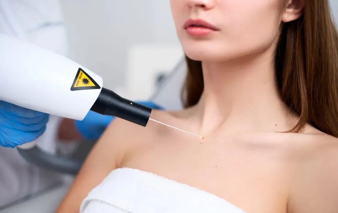 如何判断新长的痣是不是黑色素瘤,正常痣和黑色素痣图片对比说明