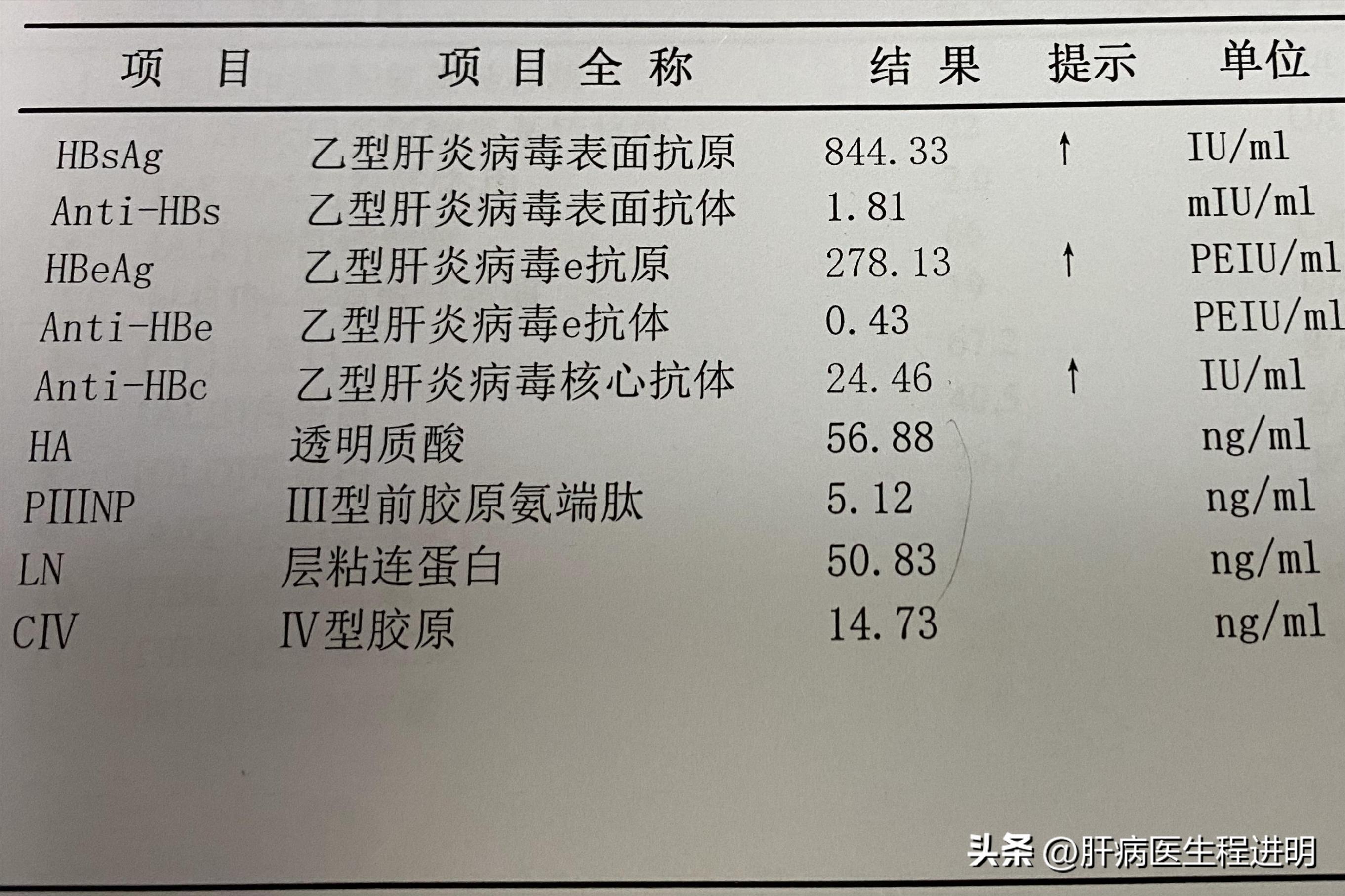 2022年乙肝患者有救吗,治疗肝纤维化肝硬化患者的新希望
