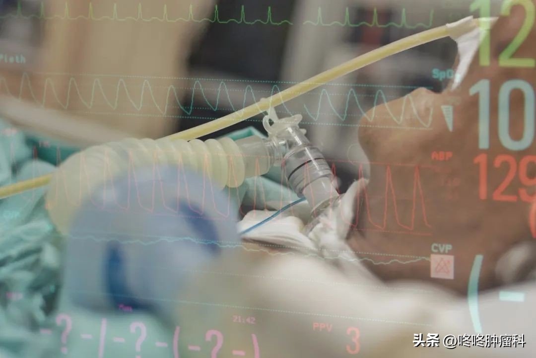 肝癌破裂出血生存期,肝癌破裂出血护理查房