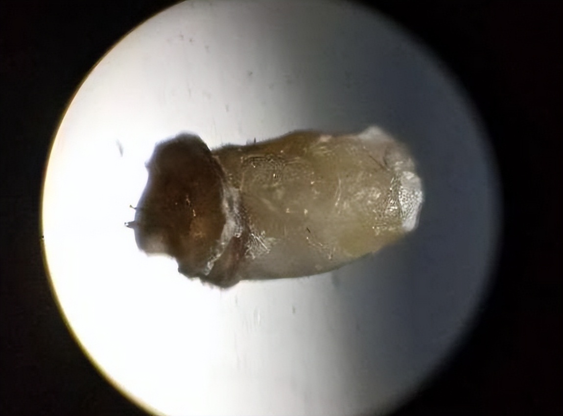 鼻子上挤出来的白色东西如何去除,鼻子上挤出来的白色分泌物是什么